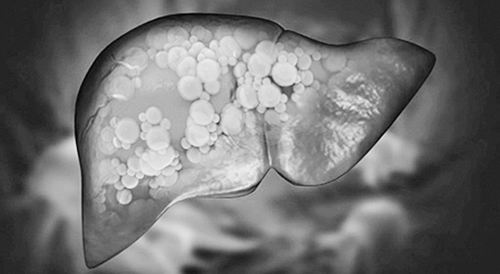 山梨糖醇等代糖或损害肝脏，新研究揭示其潜在风险(图1)