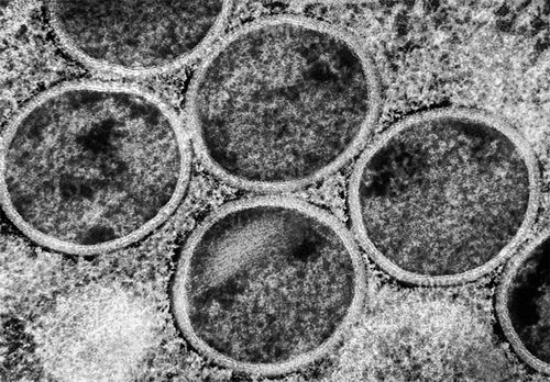 猴痘病毒进化与传播研究新发现：对男性生育能力的影响(图1)